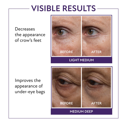 60-SECOND EYE EFFECTS™