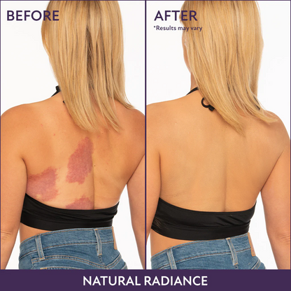 BODY COVERAGE PERFECTOR